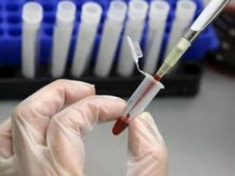 Azərbaycanda qanında QİÇS aşkarlanan daha 2 nəfər evlənməkdən imtina etdi