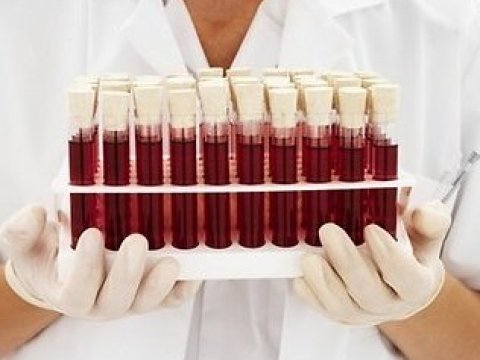 Azərbaycanda ən çox bu iki qrupdan olan qana ehtiyac var