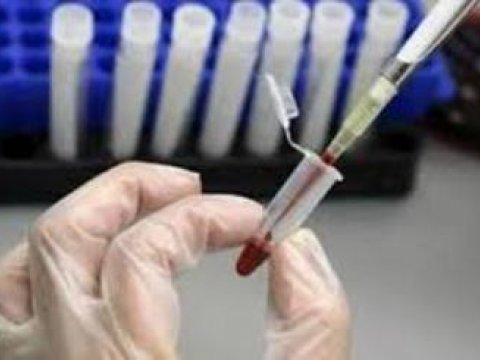  Nazirlər Kabinetinin qərarı ləğv edilib 