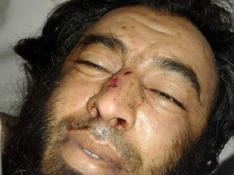 Suriyada daha bir azərbaycanlı öldürüldü – FOTO