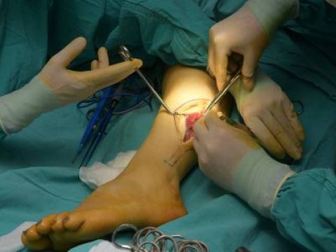 Tədris Cərrahiyyə klinikasının həkimləri unikal əməliyyat aparıblar - FOTOLAR