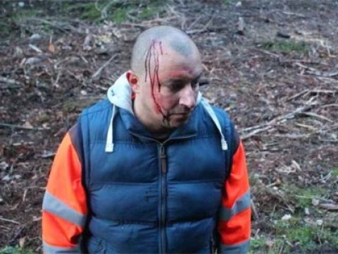   İsveçdə soydaşımız döyülüb