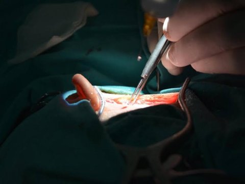 "Eşidə bilməyən uşaqları tam  sağaltmaq olur" -FOTO