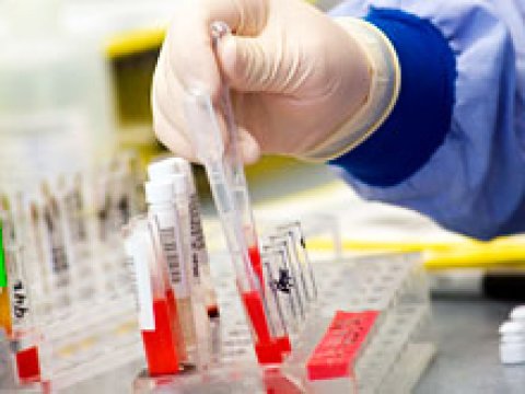 Azərbaycanda 1500-dən çox hemofiliyalı xəstə var