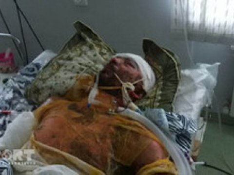  Bərdəli gənc öz avtomobilində yandırılıb 