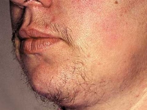 XXI əsrin qadınları tüklənir - PROBLEM   