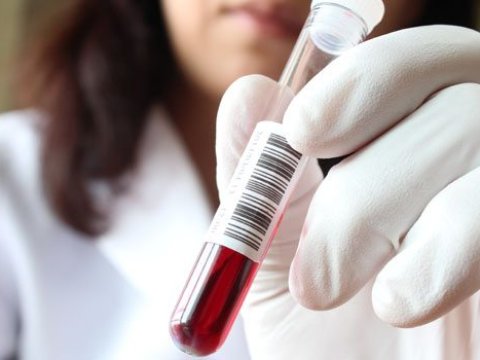 Evlənmək istəyən 225 nəfərdə təhlükəli virus aşkar edildi