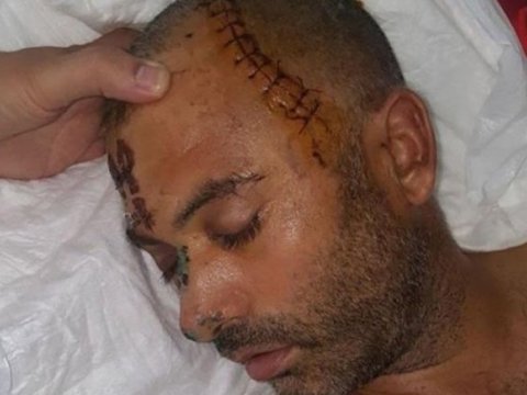 Müğənni İzzət Bağırovun “beşbarmaq”la adam vuran işçisi niyə azadlığa buraxıldı? - FOTO   