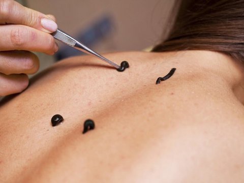 SOS: “Belə getsə, Azərbaycan göllərində zəli qalmayacaq, elə canlı növləri isə var ki, yoxa çıxıb”