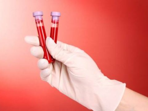 Bu unikal vasitələr SAĞLAMLIĞINIZ ÜÇÜN VACİBDİR