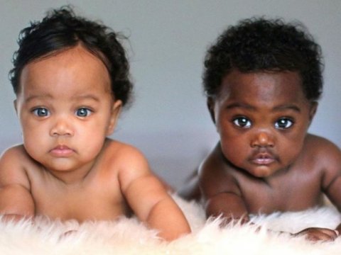 Afrika əsilli əkizlər fərqli dəri və göz rəngləri ilə doğuldu - FOTOLAR