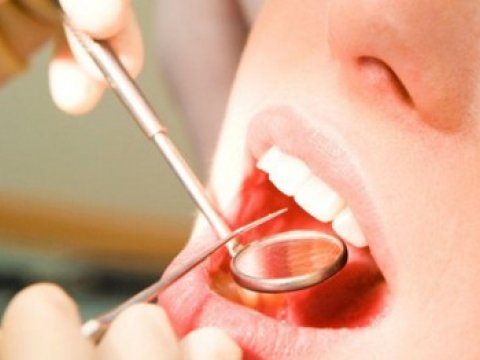 Diş həkiminə gedənləri gözləyən dəhşətli TƏHLÜKƏ