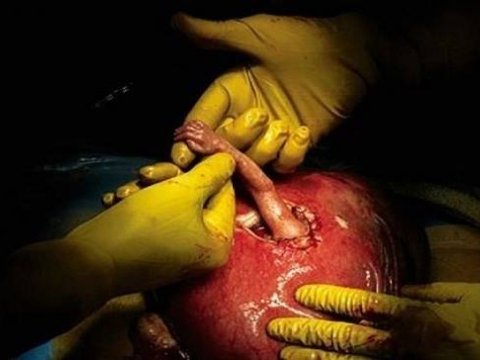 Dünyanın ən həssas fotosu – KÖMƏYƏ UZANAN ƏLLƏR... 