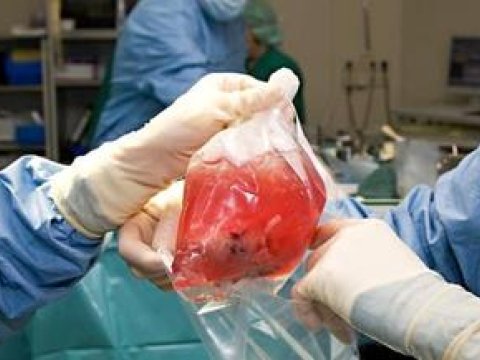 Azərbaycanda 81 nəfərə böyrək, 3 nəfərə qaraciyər köçürülüb  