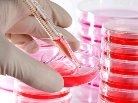 Bakı və Sumqayıtda&nbsp;hemofiliyalı xəstələrin sayı artıb