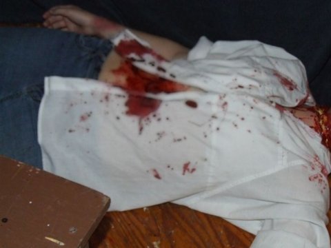 T&uuml;rkiyədə azərbaycanlı qadın d&ouml;y&uuml;lərək &ouml;ld&uuml;r&uuml;ld&uuml;