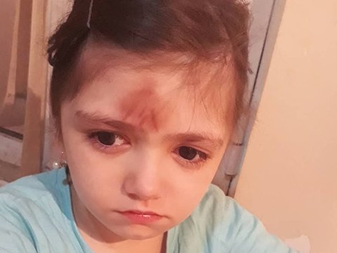 Birinci&nbsp; sinif şagirdini d&ouml;yən m&uuml;əllim işdən &ccedil;ıxarıldı