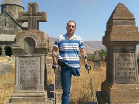 Paşinyanın yeni nazirlərindən biri ayağını Qarabağda itirib