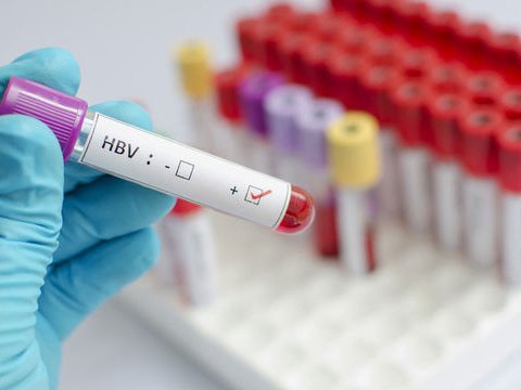 Hepatitli xəstələrə hansı pulsuz dərmanlar verilir? - Nazirlikdən AÇIQLAMA  