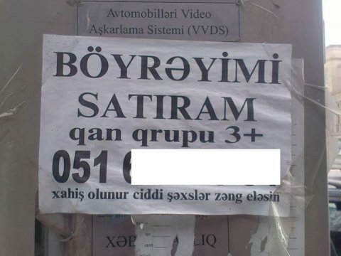 Böyrəyini satmaq istəyən azərbaycanlılar...   