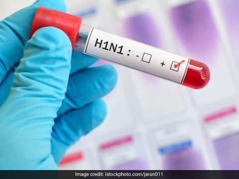 Baş epidemioloq Azərbaycanda 16 nəfərin A/H1N1 virusuna yoluxduğunu TƏSDİQLƏDİ