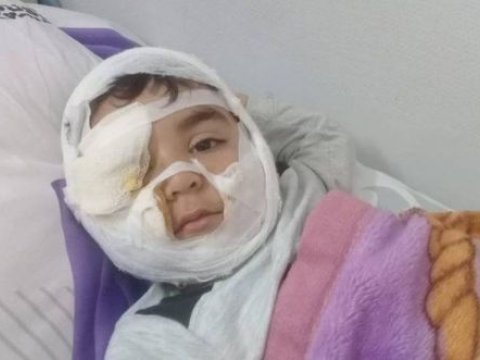İt dişləyən uşağın atası FƏRYAD ETDİ: “Həkimlər 40 gün vaxt qoyublar”  