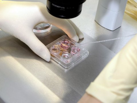 100 min QİÇS-ə yoluxub, amma bundan xəbəri yoxdur - TƏHLÜKƏ