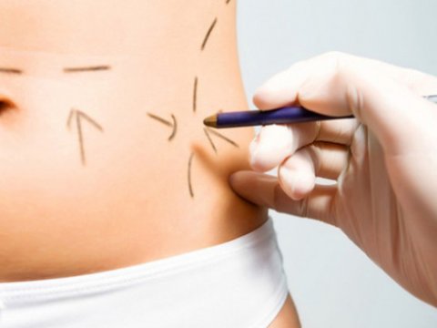 Həyatını riskə atan azərbaycanlı qadınlar - Onların sayı niyə artıb?