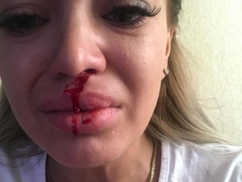 Burun-dodaq əməliyyatlarından uğursuz çıxan QADINLAR 