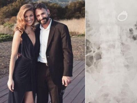 Gecə yuxu görən qadın üzüyünü uddu - FOTO