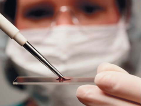 Süni mayalanma qadınlarda xərçəng yaradır? - Həkimdən AÇIQLAMA  