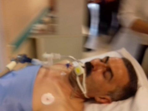 Oqtay Güləliyev əməliyyatdan ÇIXDI