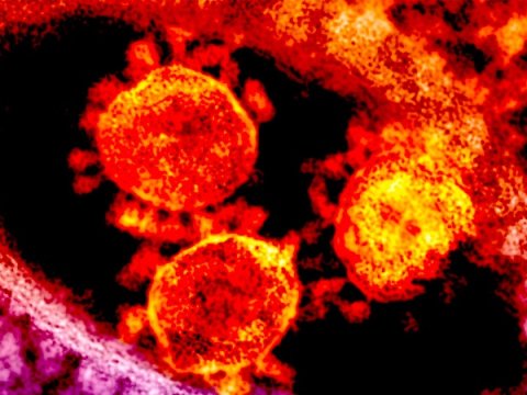 Daha bir ölkədə koronavirus tapıldı