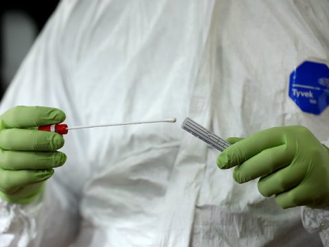 Dünyanın 102 ölkəsində koronavirus tapılıb