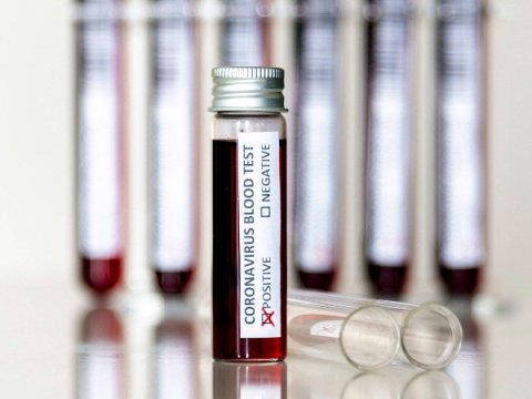 Daxili işlər naziri koronavirusa yoluxdu