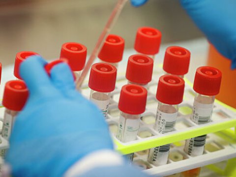 Rusiyada daha 302 nəfərdə koronavirus tapıldı