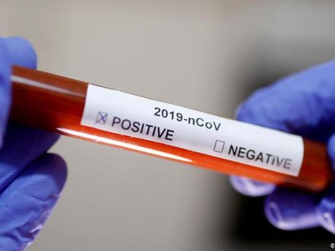 Koronavirus testi verən 11 dövlət başçısı - Onlardan 2-si virusa YOLUXUB
