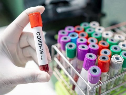 Koronaviruslu xəstələrin 91%-ni sağaldan DƏRMAN 