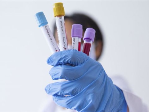 Koronavirus testindən necə keçmək olar? - TƏBİB-dən AÇIQLAMA 