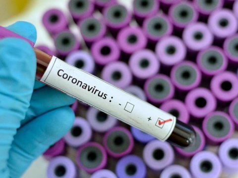 Azərbaycanda daha 39 nəfər koronavirusa yoluxdu, 59 nəfər sağaldı 