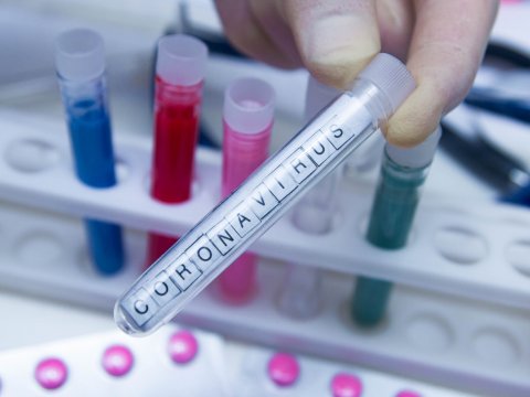 Azərbaycanda heç bir məhbusda koronavirus aşkar edilməyib - RƏSMİ