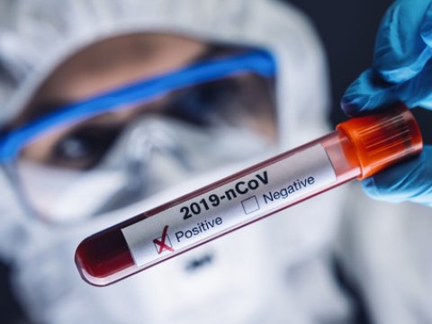 Operativ Qərargah koronavirusla bağlı testlərin sayını açıqladı
