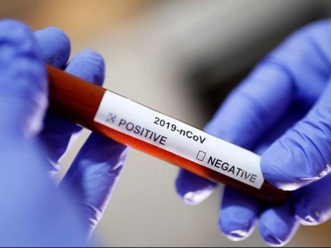 Gürcüstanda koronaviruslu xəstələrin sayı ARTDI