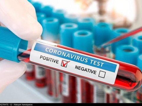 Azərbaycanda 197545  nəfər koronavirus testindən keçib