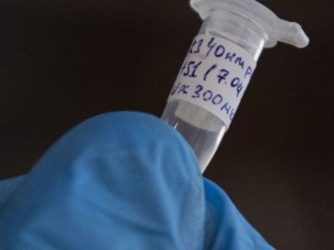 Ermənistanda virusa yoluxanların sayı daha 230 nəfər ARTDI