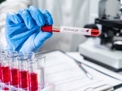 Dərbənddə 6 Azərbaycan vətəndaşında koronavirus tapılıb