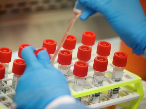 Ölkədə koronavirusla bağlı testlərin sayı açıqlandı - RƏSMİ