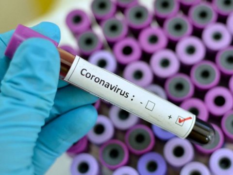 Azərbaycanda 10 partiya bir araya gələ bilmədi - Səbəb koronavirusdur, yoxsa...