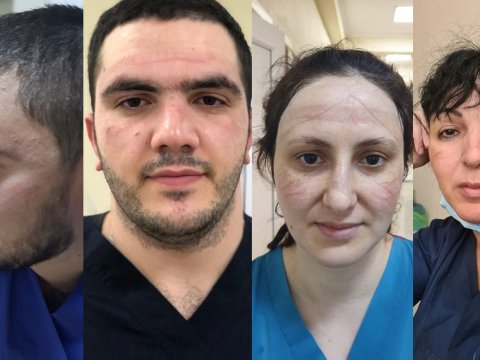 Bu günümüzün qəhrəmanları: virusla mübarizə aparan TİBB İŞÇİLƏRİ - FOTO