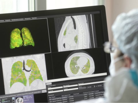 Koronaviruslu xəstə müalicə xərclərindən şok keçirdi - 1 milyon dollar…